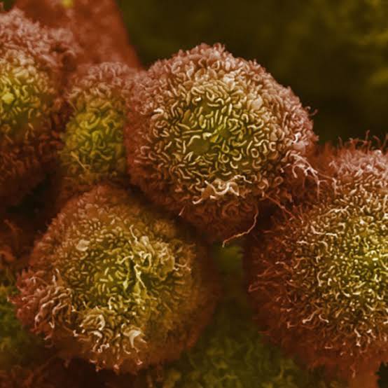 Revolution Medicines touts ‘unprecedented’ data for pancreatic cancer pill