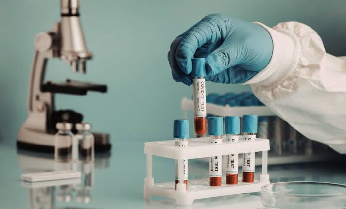 Blood Test Could Predict Alzheimer’s Risk Long Before Symptoms Surface, Paving the Way for Early Detection