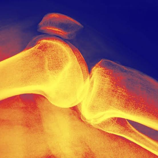 This Is Exactly How Long It Takes to Increase Your Bone Density, According to Doctors