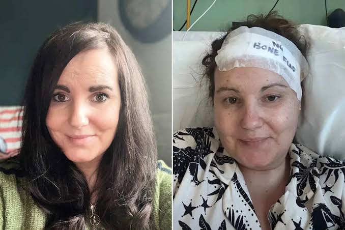 38-Year-Old Mom Discovers She's Had Brain Tumor for 15 Years After Doctors Dismissed Her Headaches as Postpartum Anxiety