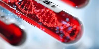 What the NHS-Galleri trial really tells us about multi-cancer early detection