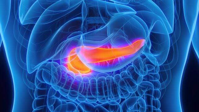 AI Can Spot Pancreatic Cancer Years Before Diagnosis, Study Finds