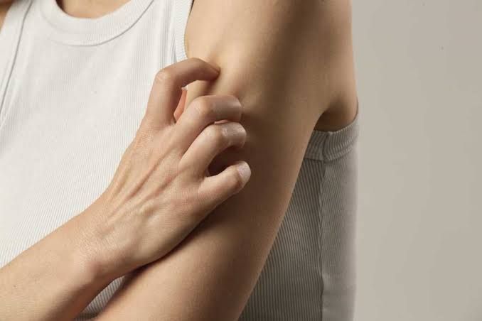 Shingles can hit younger than you think. The vaccine can prevent the painful illness