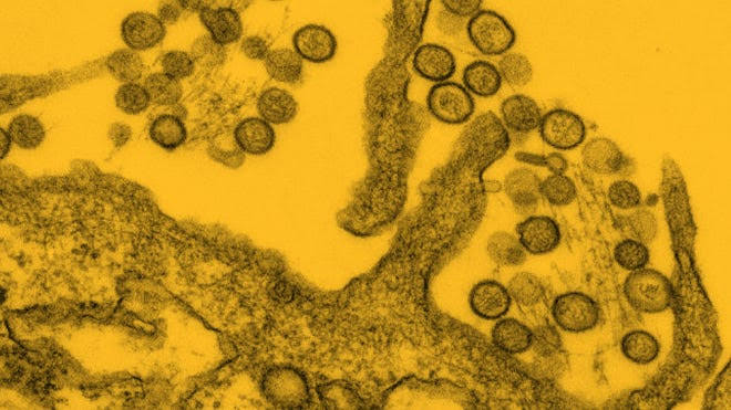 Has hantavirus ever been in the Washington DC area?