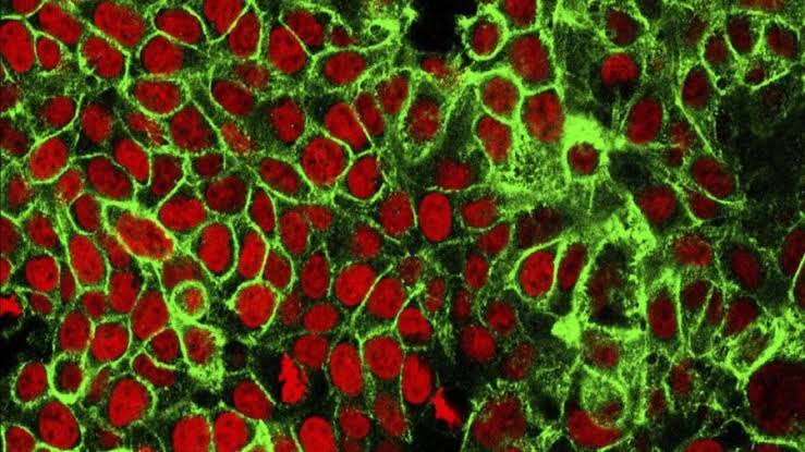 ‘Treatable, but not curable’: Mother warns others after stage 4 colon cancer diagnosis at 33