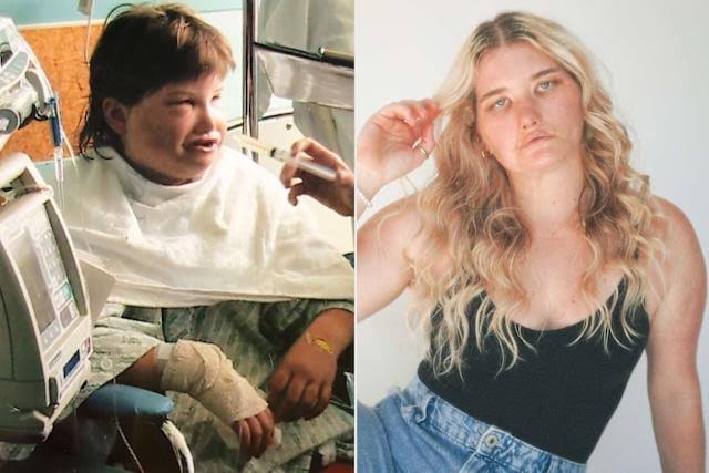 She Underwent ‘Smile Surgery’ at 11. After Looking in the Mirror, the Results Left Her ‘Broken’ (Exclusive)