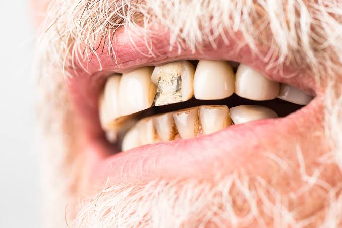 Scientists Discover Stem Cells That Could Regrow Teeth and Bone