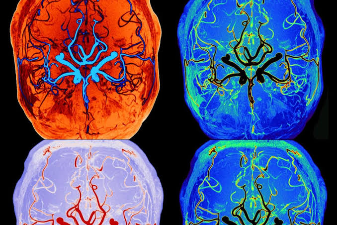 Scientists Watch Brain’s Self-Cleaning Process During Sleep in Real Time