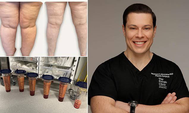 Why that menopausal fat really WON'T budge... and how hope IS at hand