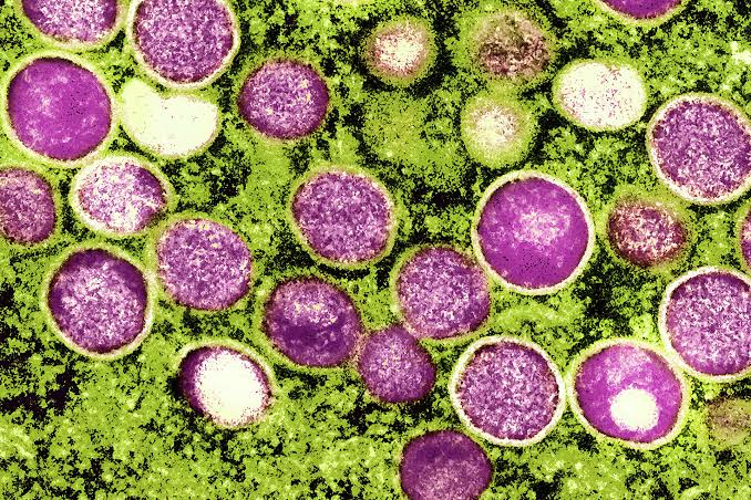 California officials worry as weekly average of rare viral cases rise