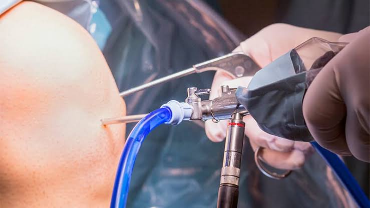 10-Year Data Confirm No Benefit From Knee Arthroscopy