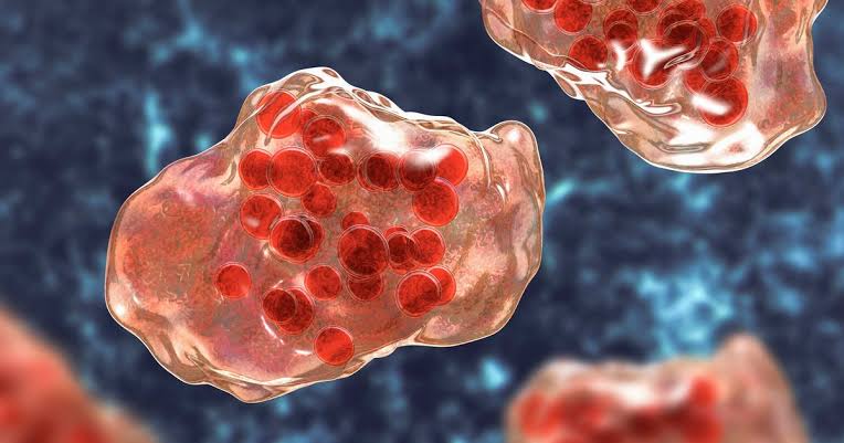 San Francisco health officials confirm measles in infant; first case since 2019