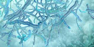 No sputum needed: Easy-to-use TB test shows accuracy in 7-country analysis