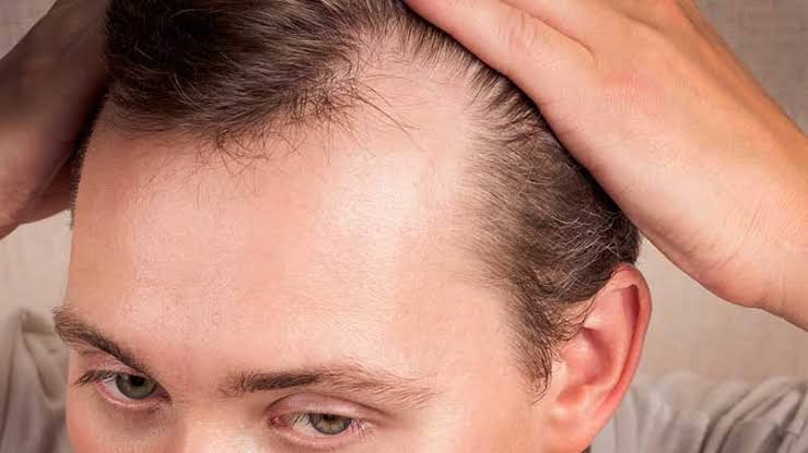 Two Hair Loss Drugs Not Tied to Heart Disease Risk