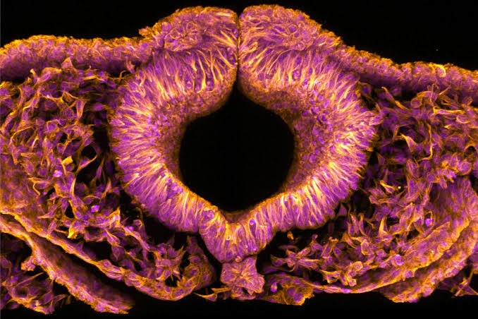 Fluorescent quail embryos could help solve serious birth defects in humans