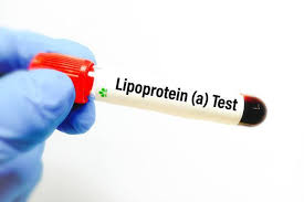 New cholesterol guidelines recommend Lp(a) blood test