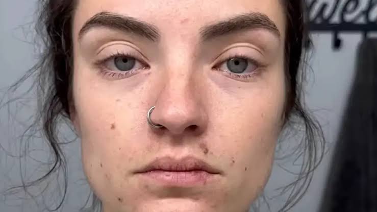 Woman shares before and after of going 30 days without drinking alcohol