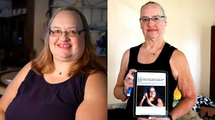 Along with rapid weight loss, patients see other benefits and risks of GLP-1 drugs