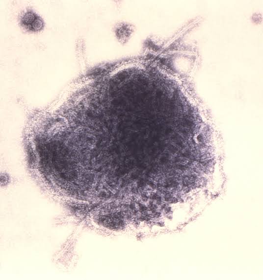 US nears 1,700 measles cases, with 73 new infections in Utah