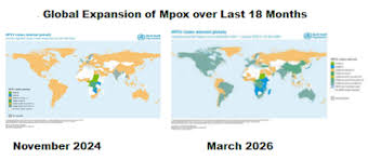 Mpox Clade Ib: 1st Local Transmission in Denmark & Wastewater Detection in Hawaii