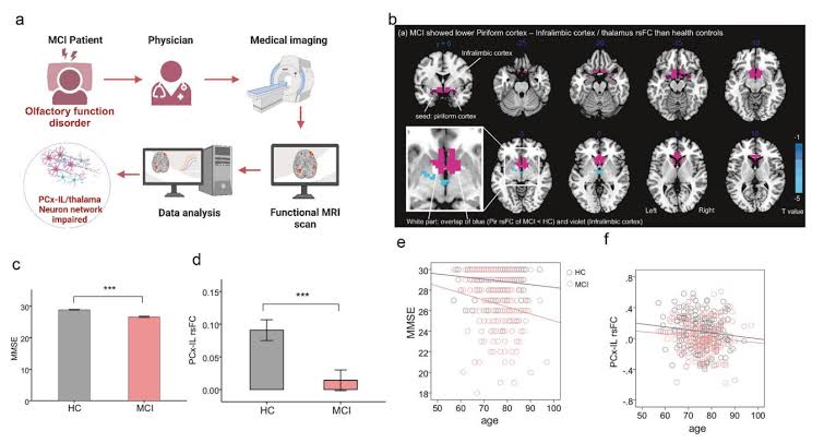 New biological marker of early-stage Alzheimer's disease uncovered