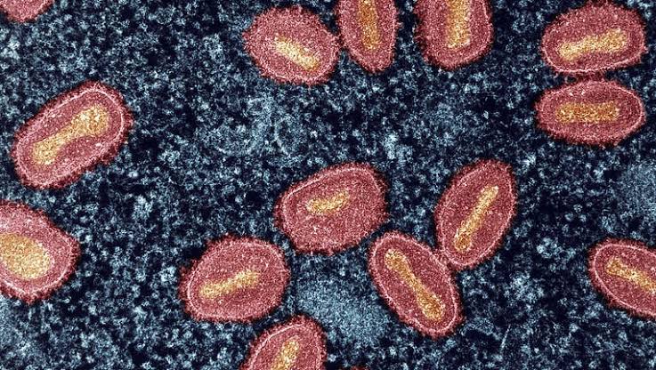 SF Department of Public Health confirms first clade I mpox case