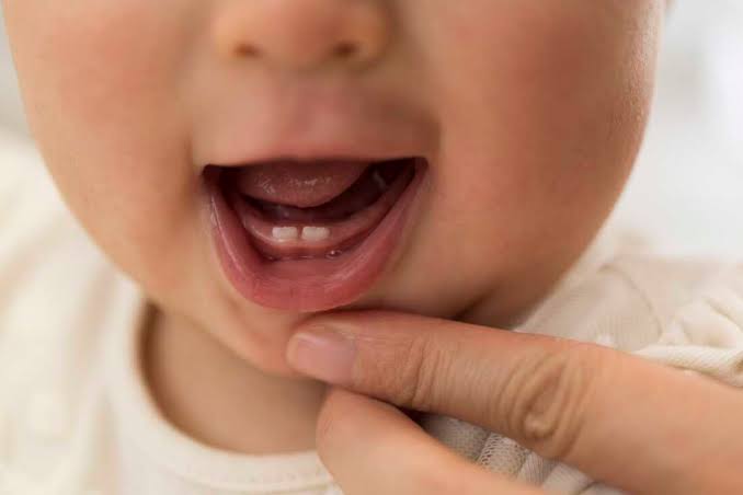 Baby teeth hold clues to the harms of toxic metals for infants — and older kids