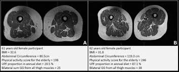 People who consume ultra-processed foods have worse muscle health