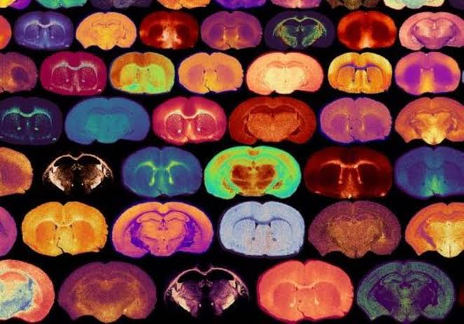 Glucose Levels Signal the Growth of Myelin