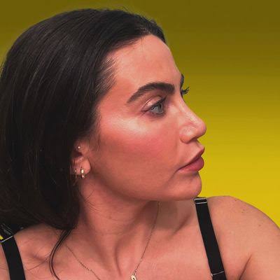 Why I Got a Nose Job in My Mid-30s