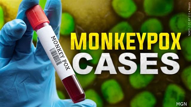 Monkeypox Strain Found In San Francisco
