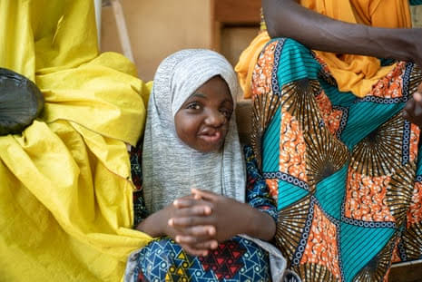 ‘Astonishing’ discovery could help save children from deadly disfiguring condition | Global development