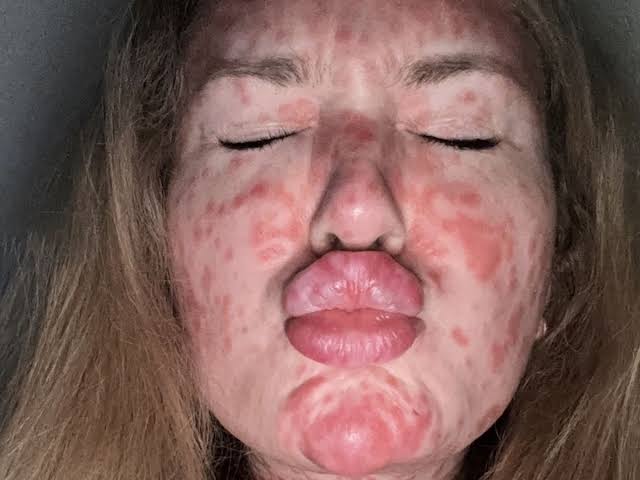 'I caught a Victorian disease that made people avoid me - and fell pregnant'