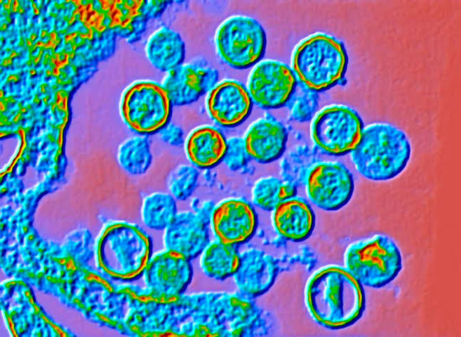 Is hantavirus the next COVID? Is the U.S. response on point? An outbreak update