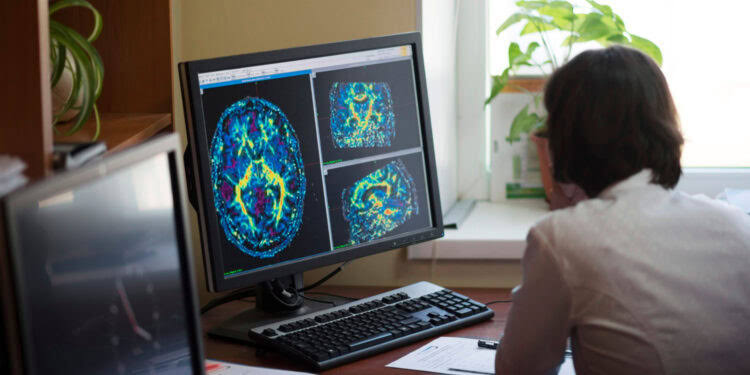 Severe emotional outbursts in ADHD are linked to distinct brain differences, study finds