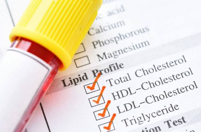What Everyone Over 30 Should Know About the New Cholesterol Guidelines