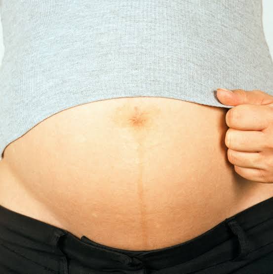 Pregnancy reshapes the brain. But each pregnancy may do it differently.