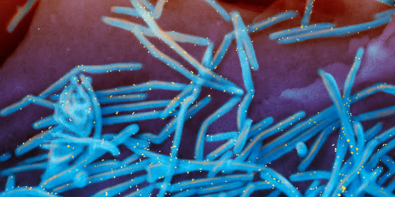 Virginia offers case-by-case RSV protections instead of an extended immunization period