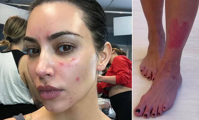 How to cure psoriasis WITHOUT drugs: ETHAN ENNELS reveals the answers