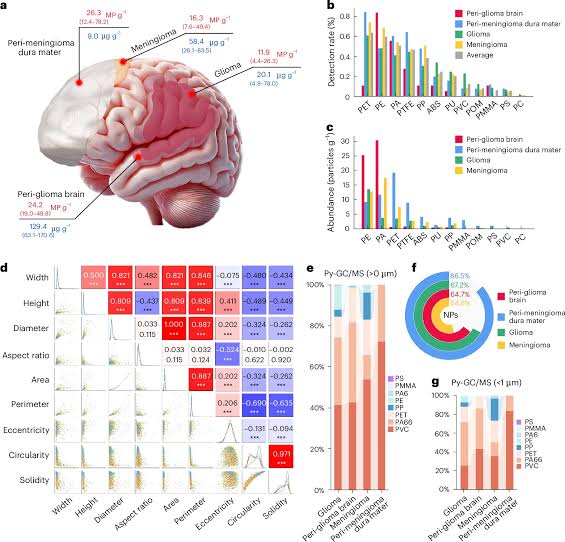 Microplastics turn up in nearly every human brain sample, including healthy tissue