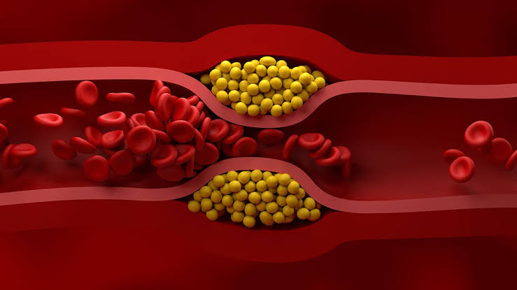 US Cardiologists Have Just Published New Guidelines For Managing Cholesterol