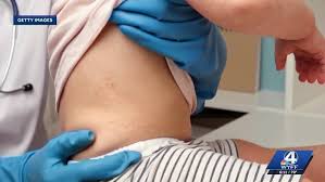 State measles outbreak officially over after 200 days and 997 cases