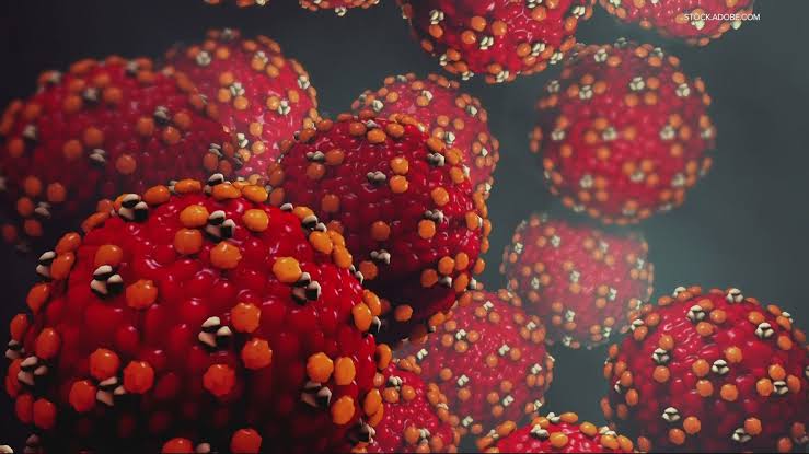 OHA reports increased rate of measles in Oregon