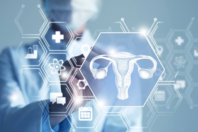 PCOS Renamed PMOS in Landmark Shift Reflecting Metabolic and Endocrine Features
