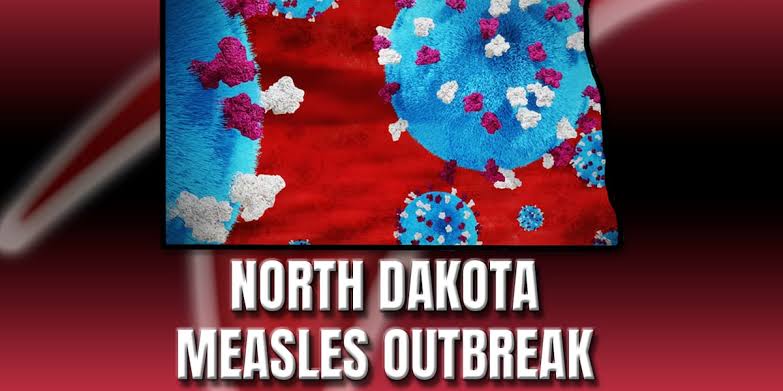 North Dakota reports 35 measles cases as CDC urges vigilance ahead of summer travel