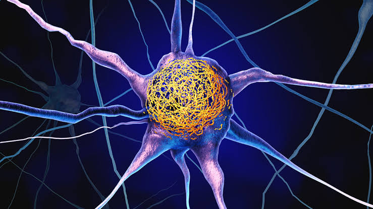 Common Vitamin May Reduce Buildup of Alzheimer's Proteins, Study Finds