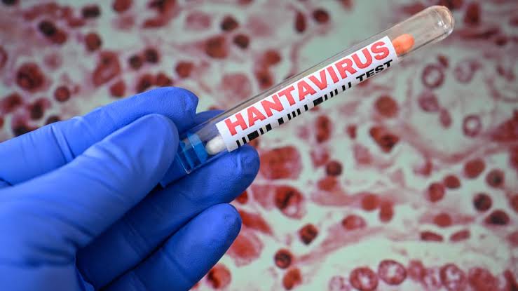 Hantavirus cases spark brief surge in pharma and biotech stocks — here’s why trading is so volatile