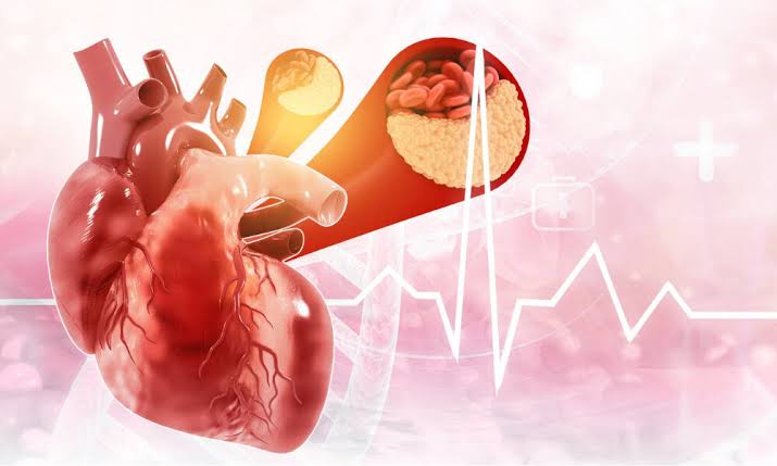 New Guidelines For Cholesterol Released: What To Know