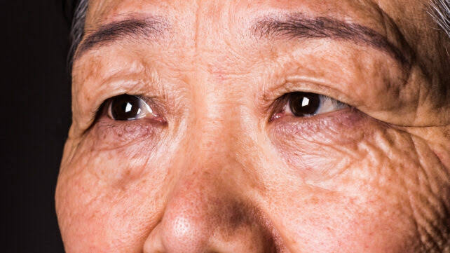 Your Vision Can Predict Dementia 12 Years Before a Diagnosis, Study Suggests