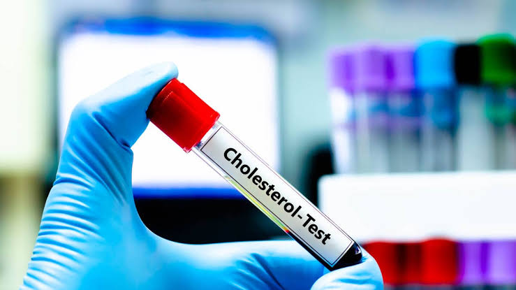 Discover Why Cardiologists Recommend One Carb for Lowering Cholesterol Levels